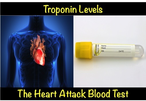 Troponin Levels