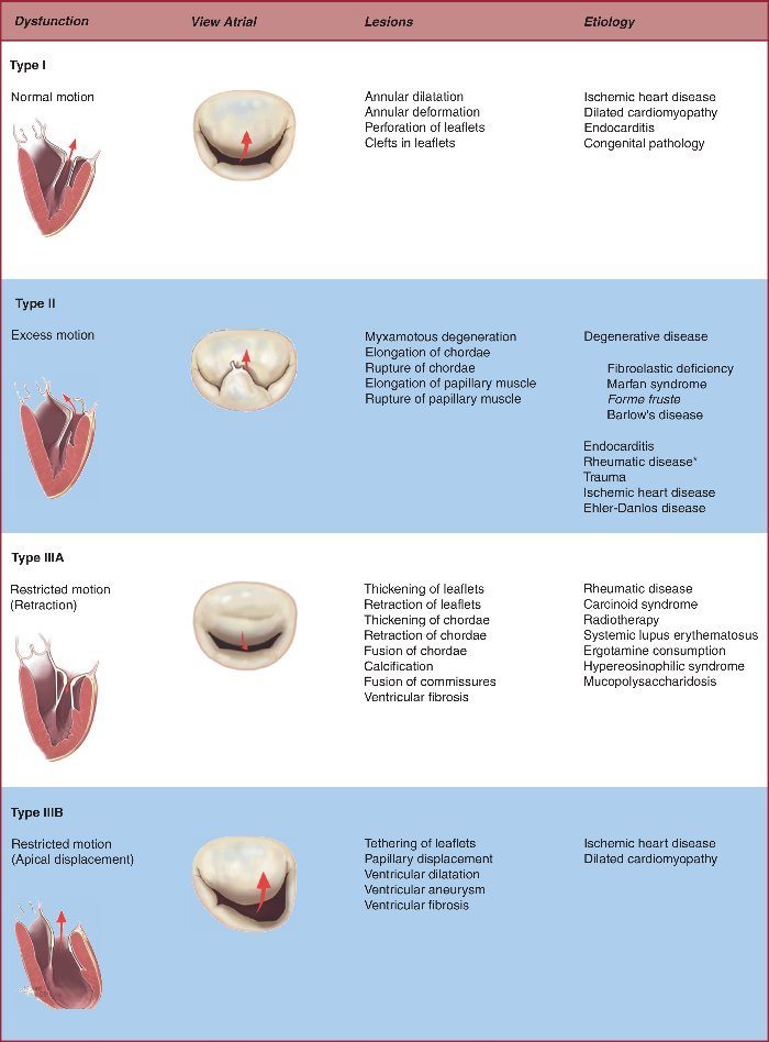 mitral-valve-causes-of-mitral-valve-regurgitation