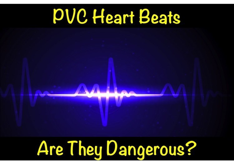 PVC Heart Beats – Are They Dangerous?