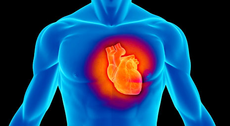 What is NSTEMI? What You NEED to Know • MyHeart
