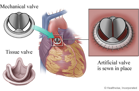 biological heart valve