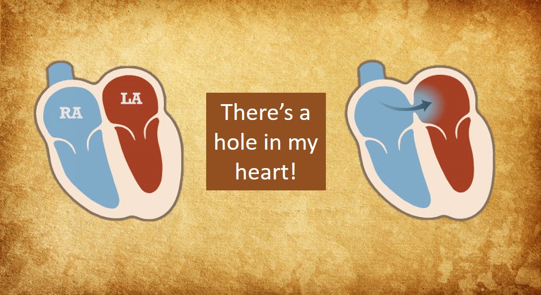 PFO - Patient's Guide to Holes in the Heart - MyHeart