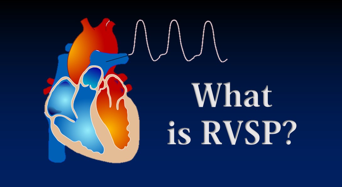 Rvsp Right Ventricular Systolic Pressure Myheart