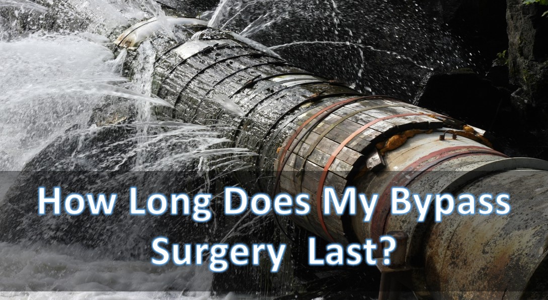 how long does my bypass surgery last