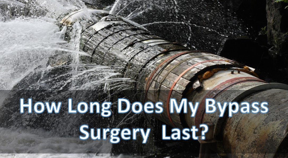 how-long-does-heart-bypass-surgery-last-myheart