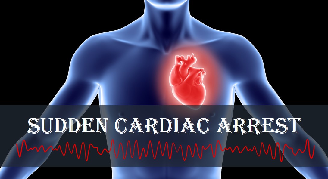 Signs Of Sudden Cardiac Arrest