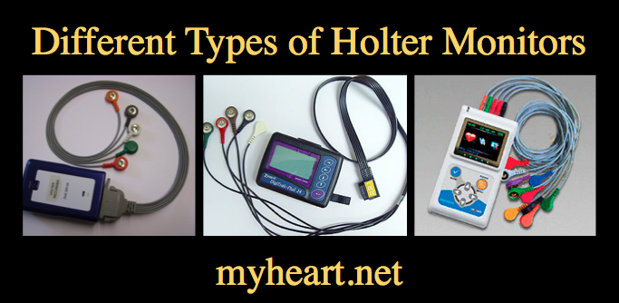 holter monitor picture