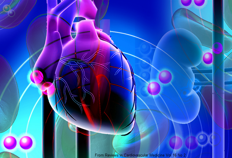 Treatment Of High Blood Pressure When Medicines Don T Work Myheart