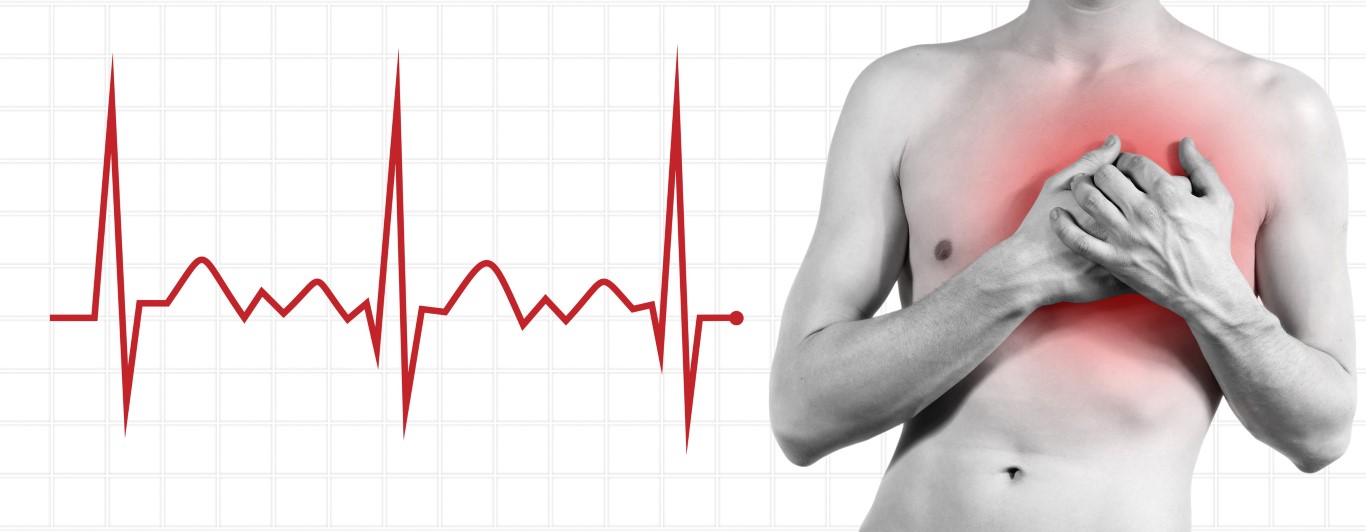 Fast Heart Rate - Symptoms, Causes and Treatments • MyHeart