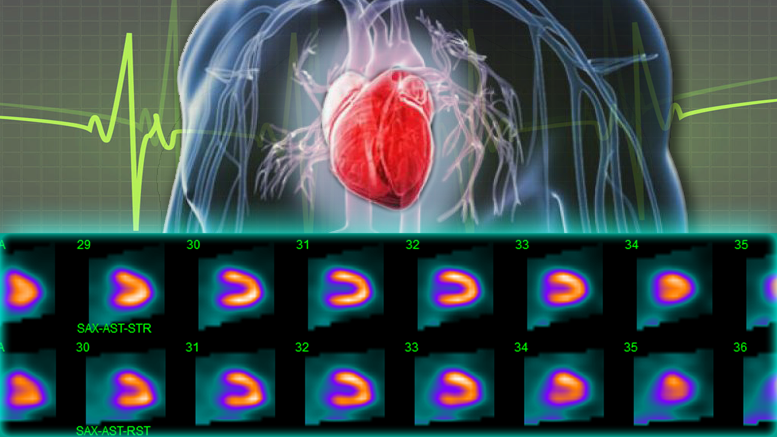 abnormal heart stress test results