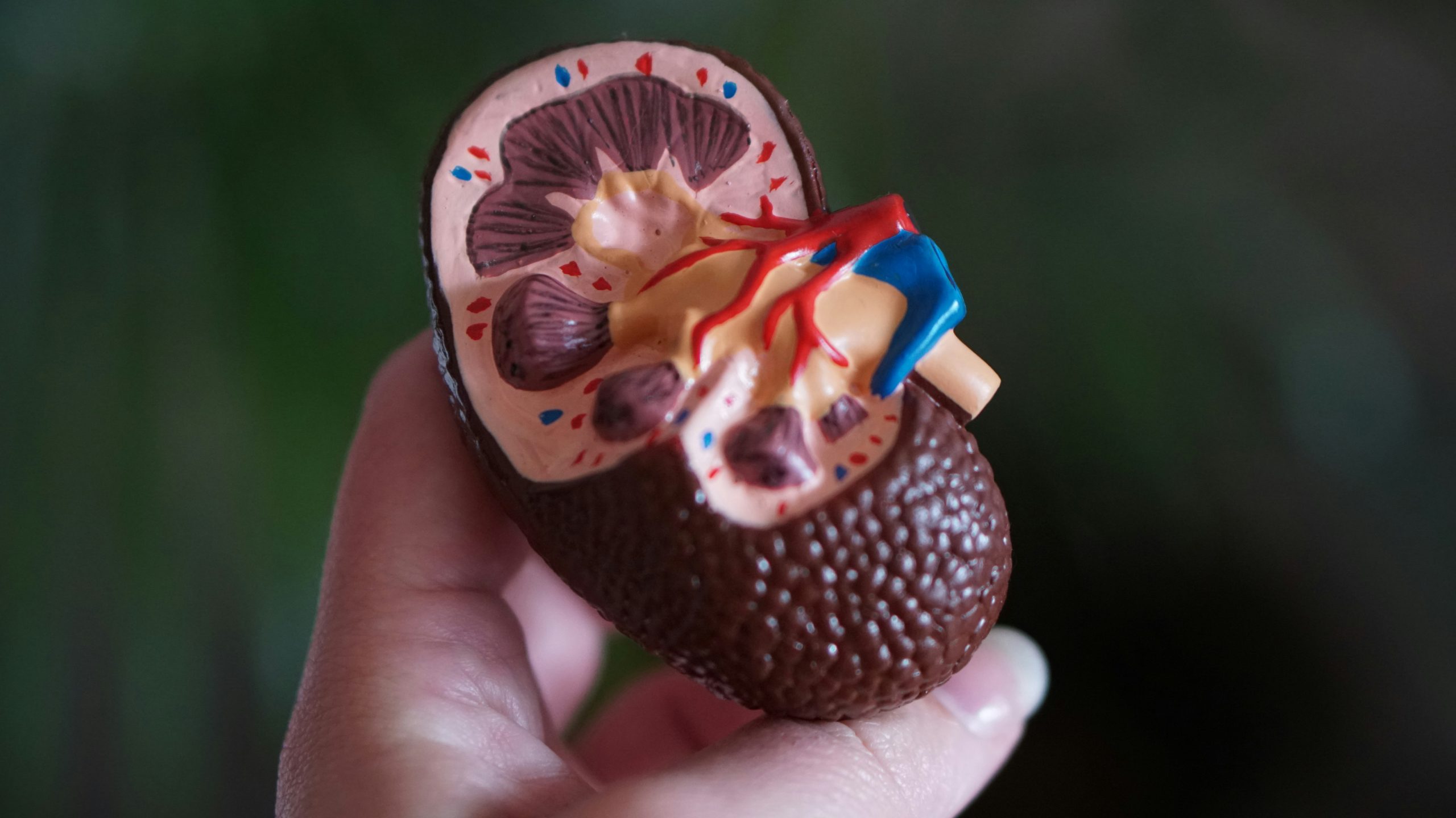A model of a kidney